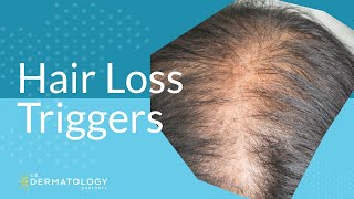 Common Hair Loss Triggers [upl. by Rashidi]