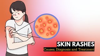 Skin Rash Causes Signs and Symptoms Diagnosis and Treatment [upl. by Eciralc638]