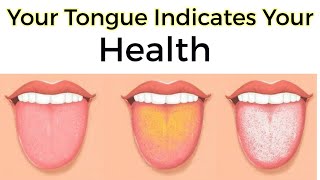 What your Tongue Says About Your Health [upl. by Iras]