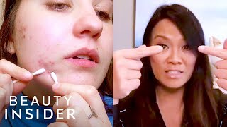 How To Pop A Pimple Yourself With Dr Pimple Popper  Beauty At Home [upl. by Namharludba744]