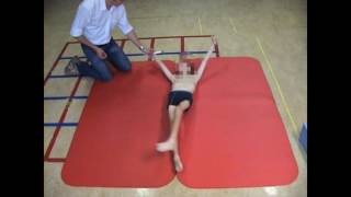 Dyskinetic cerebral palsy case 3 [upl. by Drue802]