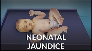 Neonatal Jaundice by L Veit  OPENPediatrics [upl. by Navad]