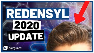 Redensyl 2020 Updates For YOUR Hair GROWTH [upl. by Ahseket761]