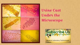 Urine CastTypes and Causes urinanalysis [upl. by Firahs]