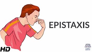 Epistaxis Causes SIgns and Symptoms Diagnosis and Treatment [upl. by Yolane353]