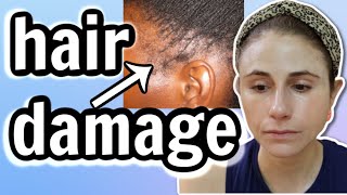 Hairstyles that DAMAGE your HAIR Traction alopecia Dr Dray [upl. by Las]