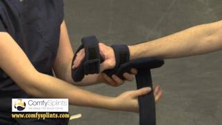 Capener orthosis  Orficast Instructional Movie 3 [upl. by Lrae]