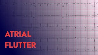 Living Arrhythmias with soundtrack [upl. by Agnew547]