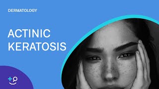 Actinic Keratosis Dermatology [upl. by Ardnaxila]