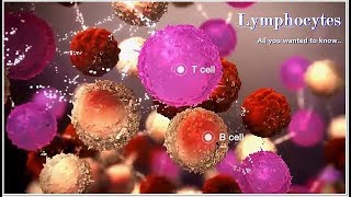 Large granular lymphocyte proliferations in MDS [upl. by Tedmund335]