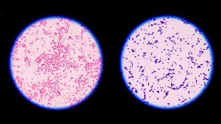 Staining technique in microbiology Gram staining [upl. by Aili]