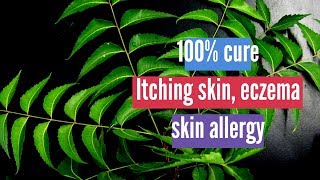 Itching skin Eczema skin allergy Best Home Remedy  Neem Oil  Problem solved [upl. by Enrico782]