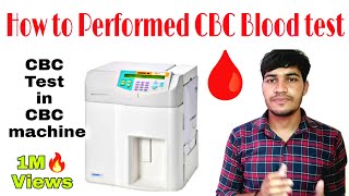 Complete Blood Count CBC  Basic Laboratory InvestigationsHomoeopathy and health [upl. by Yblek]