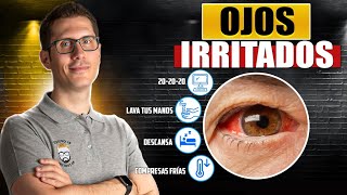 8 REMEDIOS NATURALES PARA LOS OJOS IRRITADOS [upl. by Annatnas767]