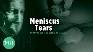 Meniscus Tears  Everything you need to know [upl. by Amsa]