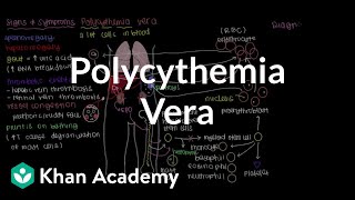 What is polycythemia vera  Hematologic System Diseases  NCLEXRN  Khan Academy [upl. by Sigrid]