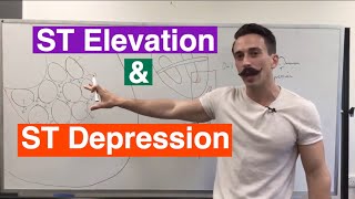 ST Elevation and ST Depression EXPLAINED [upl. by Aleuqahs321]