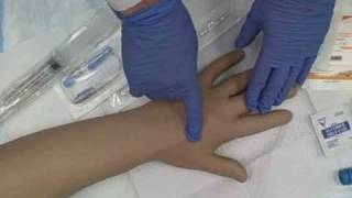 Intravenous IV Saline Lock Insertion [upl. by Melia]