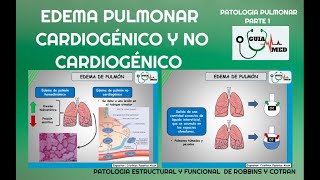 EDEMA PULMONAR CARDIOGÉNICO Y NO CARDIOGÉNICO  GuiaMed [upl. by Enneillij]