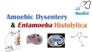 Amebiasis Amoebic Dysentery  Entamoeba histolytica Pathogenesis Signs amp Symptoms Treatment [upl. by Greenwood]