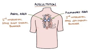 Heart Murmurs and Heart Sounds Visual Explanation for Students [upl. by Kimmi]