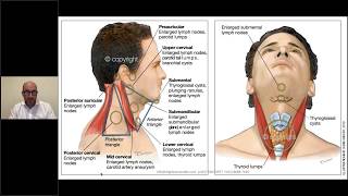 Neck lumps in general practice [upl. by Enilorac]