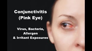 Conjunctivitis Pink Eye  Virus Bacteria Allergen amp Irritant Exposures [upl. by Pahl]