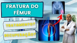 FRATURA DE FÊMUR COMO É A CIRURGIA E RECUPERAÇÃO [upl. by Enilrae]