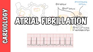 What is atrial fibrillation [upl. by Brucie]