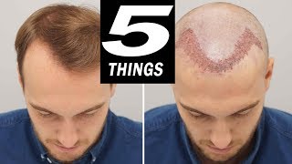 5 THINGS to do after HAIR TRANSPLANT [upl. by Fabrienne]