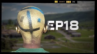 Bad Hair Day  EP18  Camp Woodward Season 9 [upl. by Sidney791]