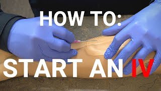 How To Start An IV [upl. by Asilej]