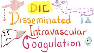 Disseminated Intravascular Coagulation DIC [upl. by Yllak]