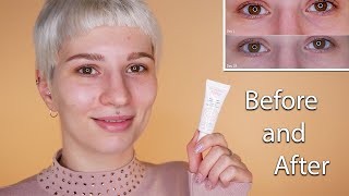 Avene Soothing Eye Contour Cream  Before amp After [upl. by Ursulina434]