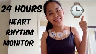 Holter Monitor  Everything you need to know [upl. by Gnort]