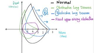 Flow Volume Loops  Respiratory Physiology  Pulmonary Medicine  Pulmonology Playlist [upl. by Notsuj]