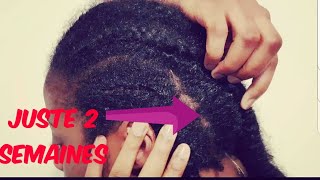 COMMENT FAIRE POUSSER SES CHEVEUX PLUS VITE JUSTE EN 2 SEMAINES [upl. by Essirehc]